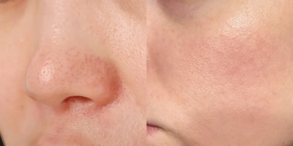 [보습광채] 퍼셀 픽셀바이옴 글로우 배리어 유산균 세럼 50ml 상세페이지 10